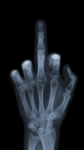 x-ray