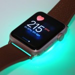 Apple Watch arsuri severe