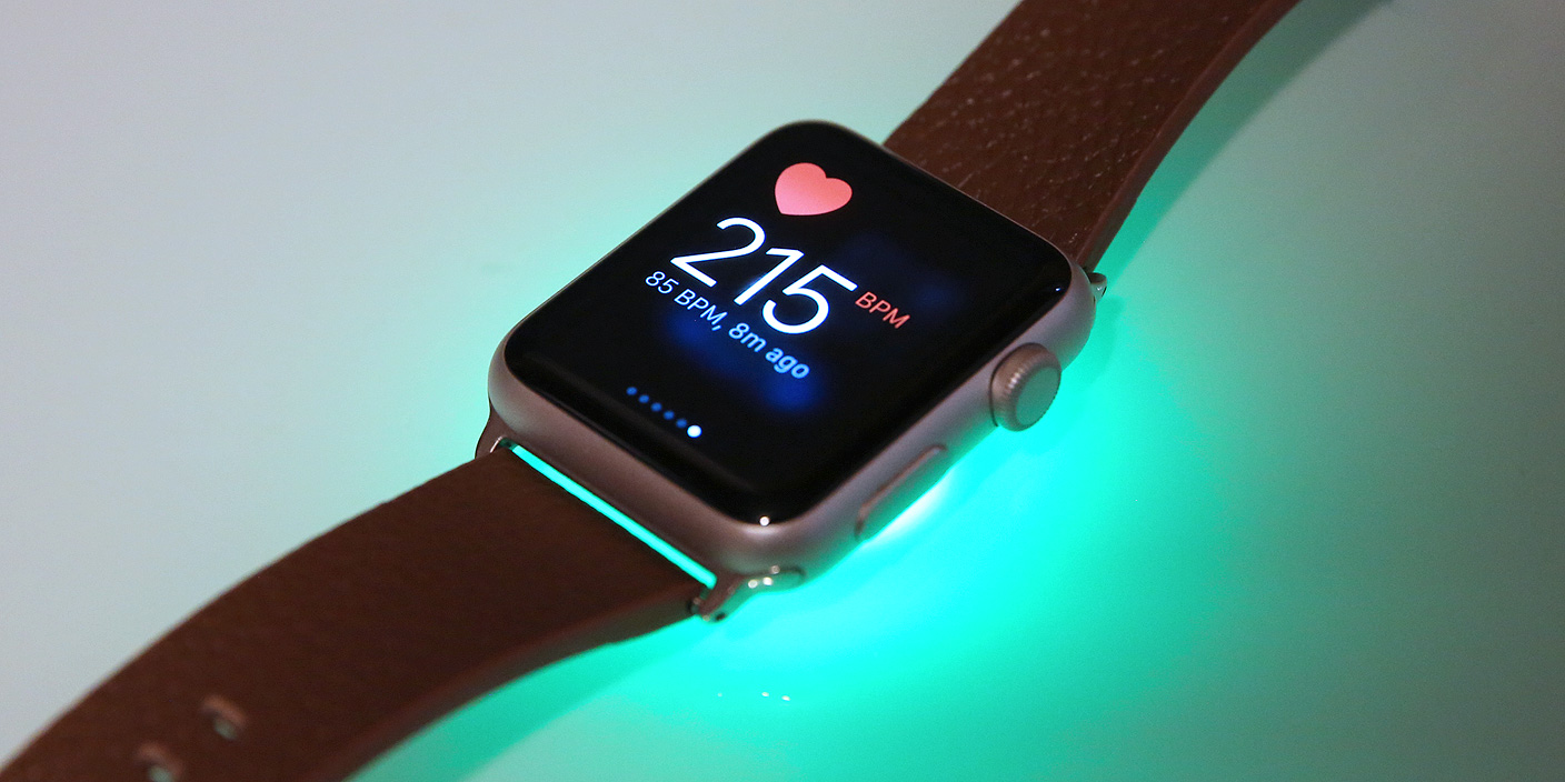 Apple Watch poważne oparzenia