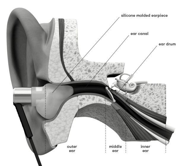 Écouteurs intra-auriculaires personnalisés Uvervo 47jpg