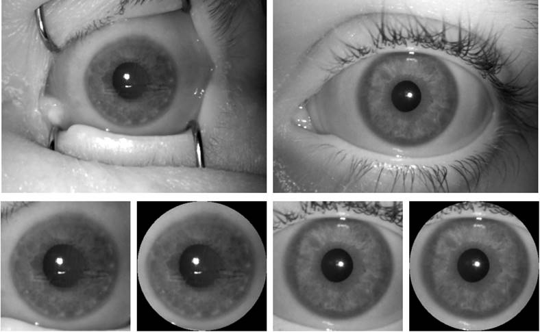 Iris Scanner Problem løst Kunstig Intelligens