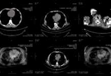 miliard imagini medicale internet