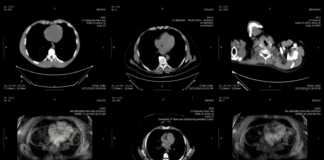 milliards d'images médicales sur Internet