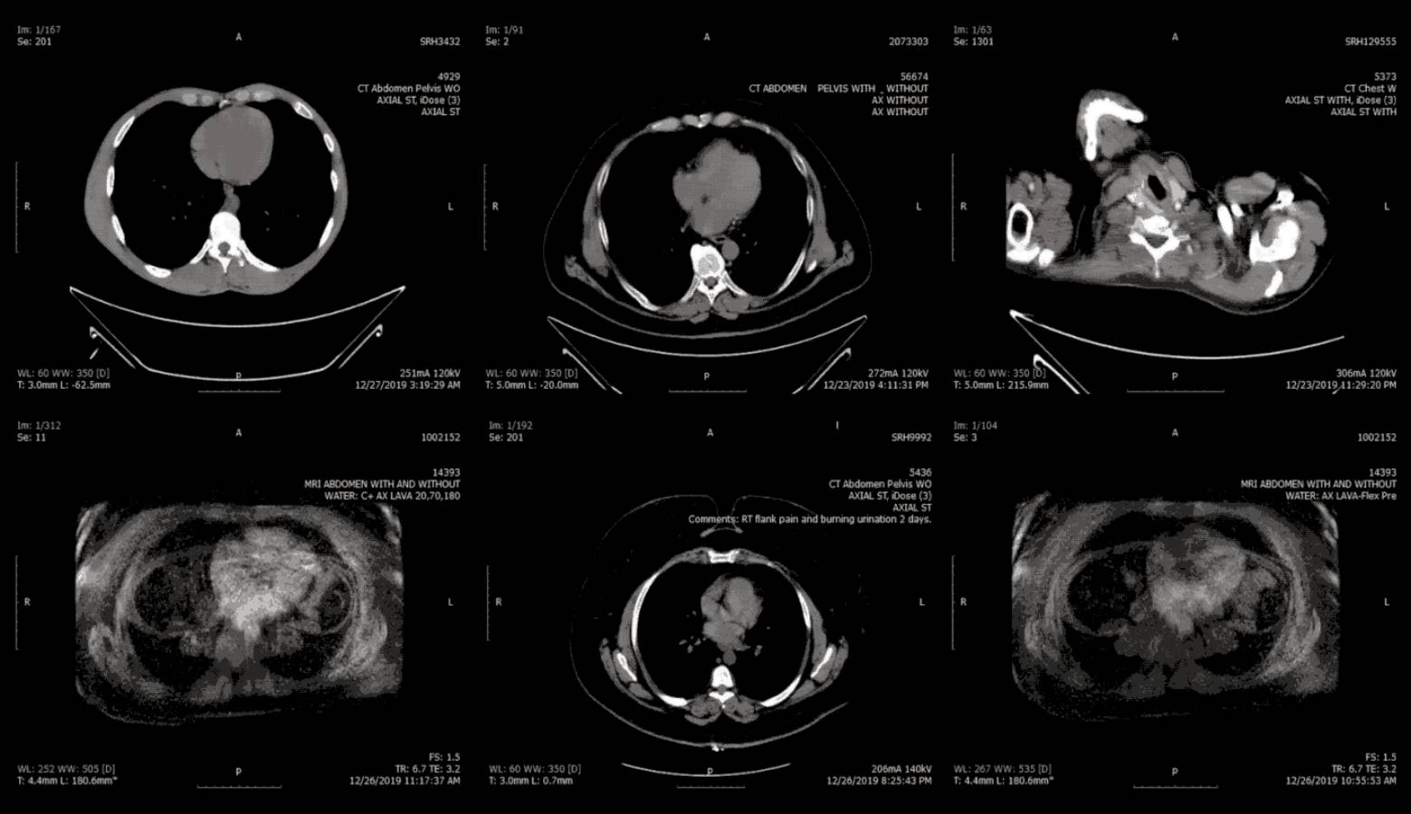 milliards d'images médicales sur Internet