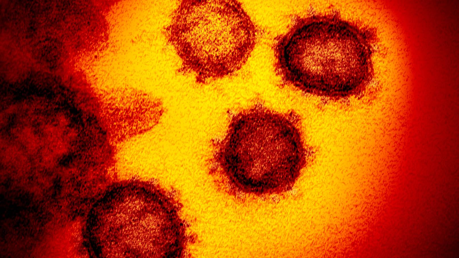 Volgen van het coronavirus in Israël