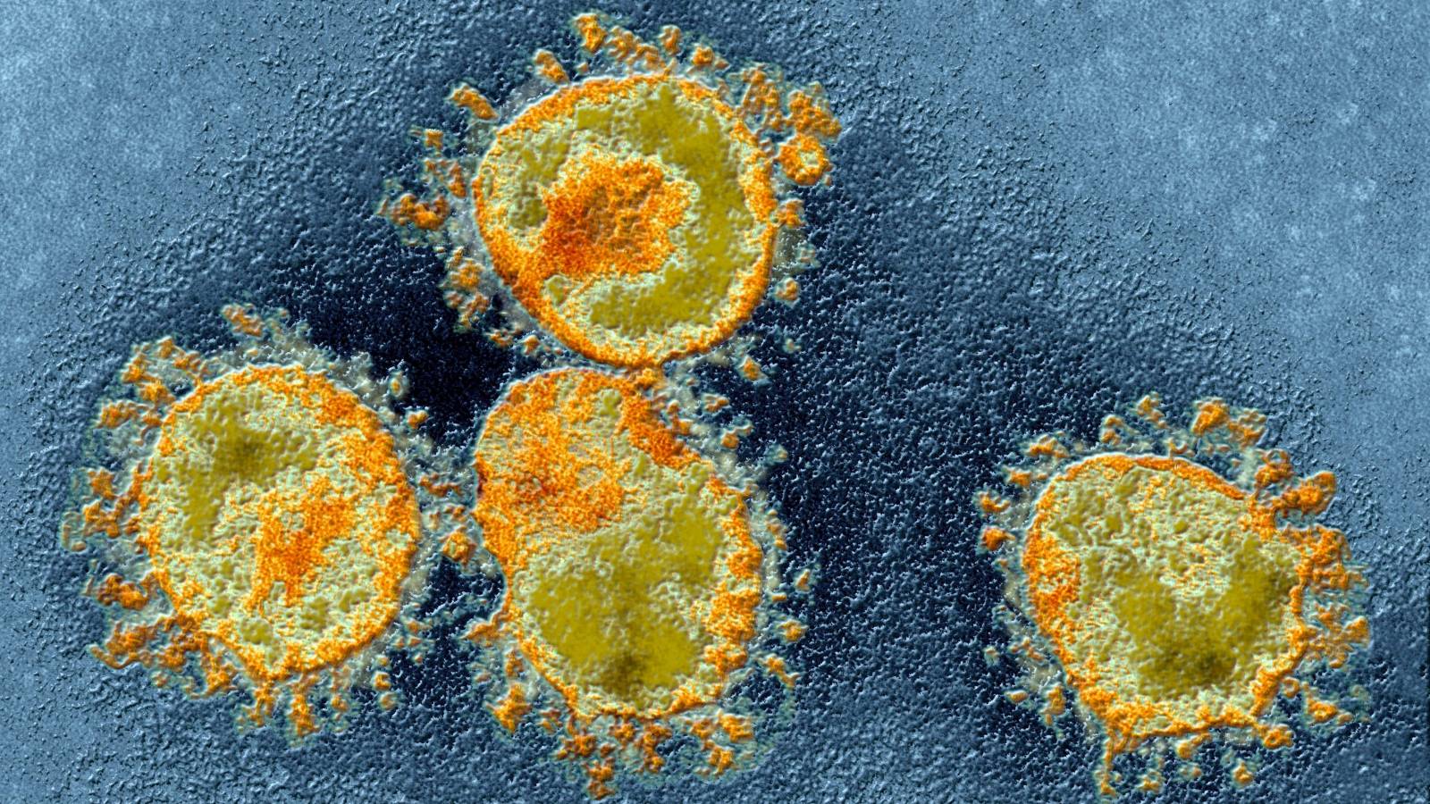 koronavirus romanian eristetty kartta