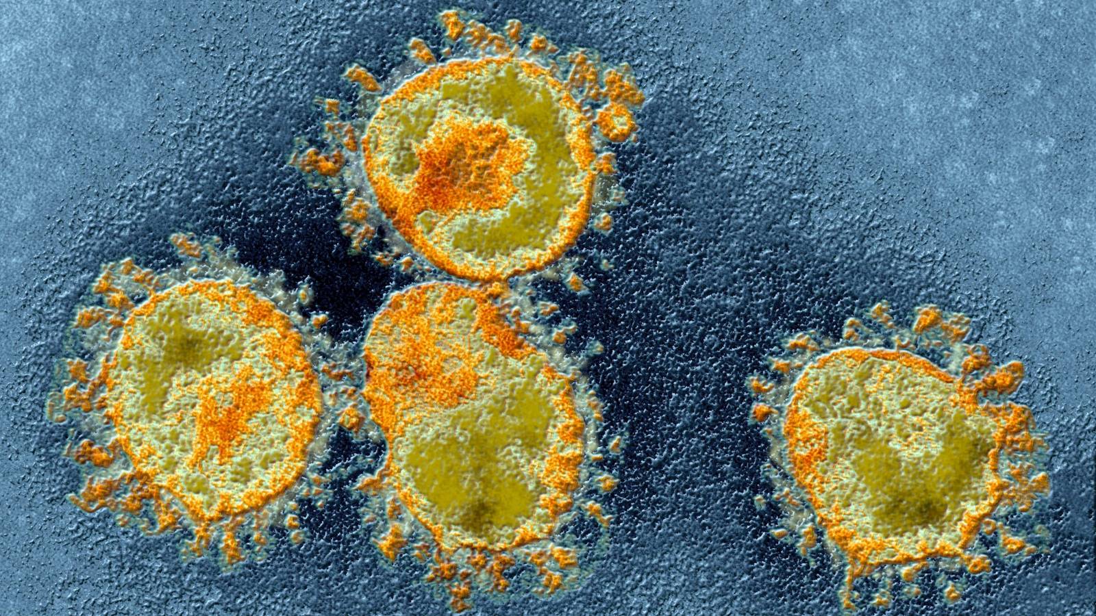 Heilung der Coronavirus-Fälle in Rumänien am 3. Juni