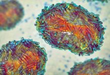 OMS Europa Alerta Anuntul Ingrijorator Toate Tarile