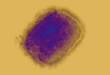 ECDC Trage un Semnal de Alarmă privind AMENINȚAREA MPOX și a Variantei mai Periculoase ECDC Trage Semnal Alarma AMENINTAREA MPOX Variantei Periculoase