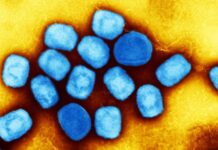 OMS Emite o ALERTĂ Globală de ULTIM MOMENT din Cauza unei Periculoase Epidemii în Derulare OMS Emite ALERTĂ Globală ULTIM MOMENT Cauza Periculoase Epidemii Derulare