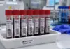 Alertă de EBOLA în Italia la 2 Călători întorși din Uganda, unde OMS a Anunțat Existența unui Focar EBOLA Italia alerta