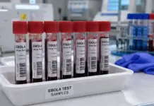 Alertă de EBOLA în Italia la 2 Călători întorși din Uganda, unde OMS a Anunțat Existența unui Focar EBOLA Italia alerta