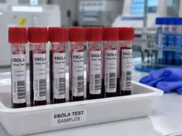 EBOLA Italia alerta