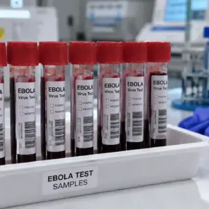 Alertă de EBOLA în Italia la 2 Călători întorși din Uganda, unde OMS a Anunțat Existența unui Focar