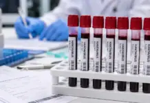 Hantavirus: Crește Numărul Infectărilor de pe MV Hondius, Anunt de Ultimă ORĂ al OMS Privind Situația Globală Hantavirus olanda infectare