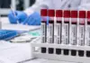 hantavirus monitorizare emag ingrijorari