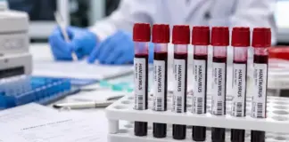hantavirus monitorizare emag ingrijorari