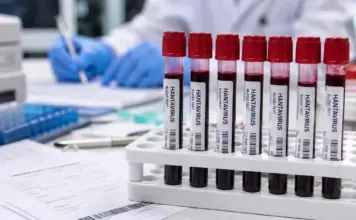 HANTAVIRUS sub Monitorizarea Atentă a EMA după Îngrijorările Generate de Cazurile Noi hantavirus monitorizare emag ingrijorari